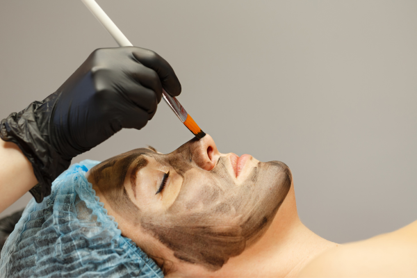 Best Carbon Facial Laser Treatment in Pimpri Chinchwad, Pune