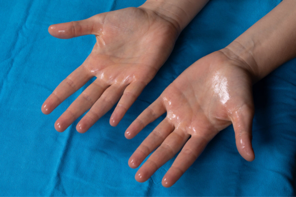 Hyperhidrosis Treatment Specialist in Pimpri Chinchwad, Pune